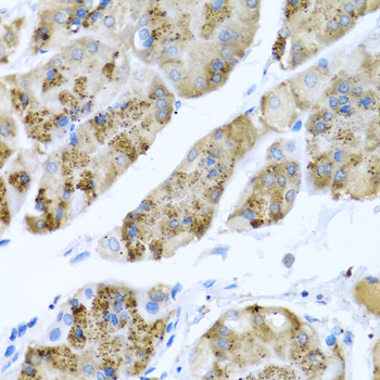 Immunohistochemistry - MGP Polyclonal Antibody 