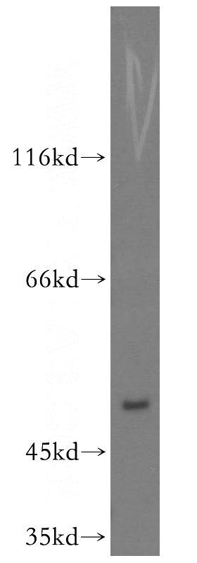 HepG2 cells were subjected to SDS PAGE followed by western blot with Catalog No:117042(ZFP36L2 antibody) at dilution of 1:500