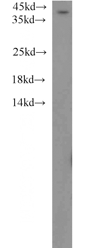 Jurkat cells were subjected to SDS PAGE followed by western blot with Catalog No:107815(ABHD5 antibody) at dilution of 1:500