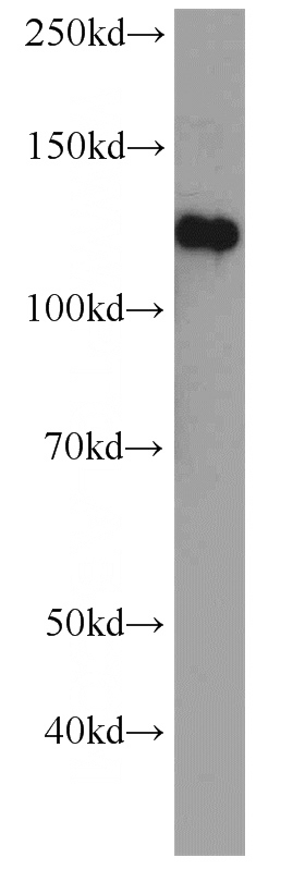 mouse brain tissue were subjected to SDS PAGE followed by western blot with Catalog No:110349(EPHA4 antibody) at dilution of 1:1000