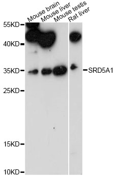 Western blot - SRD5A1 Polyclonal Antibody 