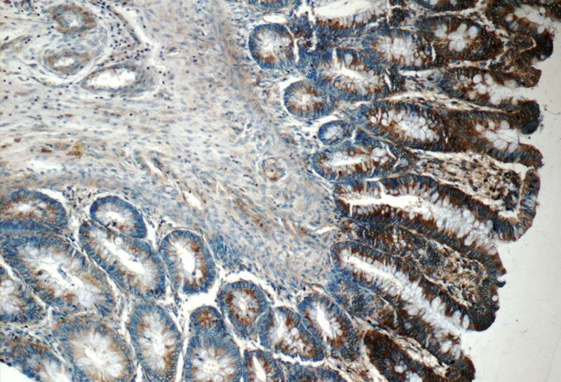 Immunohistochemistry of paraffin-embedded human colon tissue slide using Catalog No:110653(FIBCD1 Antibody) at dilution of 1:50 (under 10x lens)