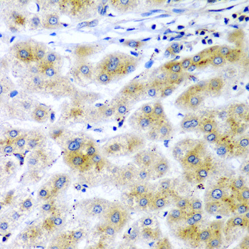Immunohistochemistry - RARRES2 Polyclonal Antibody 