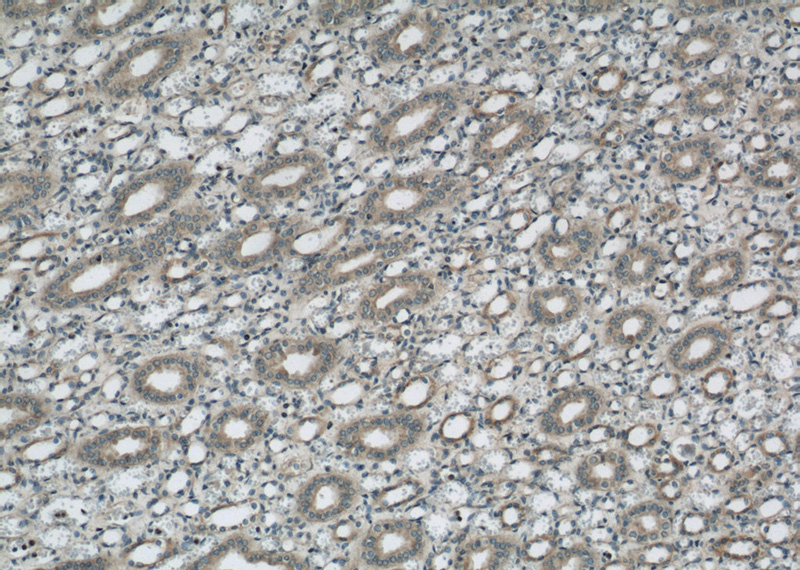 Immunohistochemical of paraffin-embedded human kidney using Catalog No:115069(ZFYVE9 antibody) at dilution of 1:50 (under 10x lens)