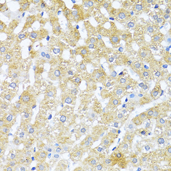 Immunohistochemistry - TGFB2 Polyclonal Antibody 