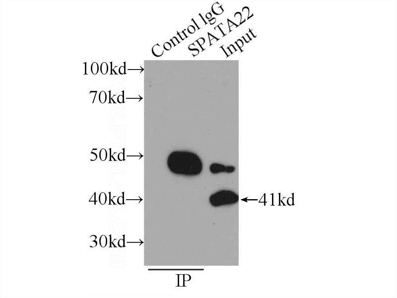 IP Result of anti-SPATA22 (IP:Catalog No:115552, 3ug; Detection:Catalog No:115552 1:500) with mouse testis tissue lysate 4800ug.