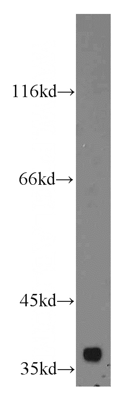 HeLa cells were subjected to SDS PAGE followed by western blot with Catalog No:109479(C1GALT1C1 antibody) at dilution of 1:800