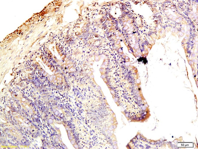 Fig2: Tissue/cell: rat intestine tissue; 4% Paraformaldehyde-fixed and paraffin-embedded;; Antigen retrieval: citrate buffer ( 0.01M, pH 6.0 ), Boiling bathing for 15min; Block endogenous peroxidase by 3% Hydrogen peroxide for 30min; Blocking buffer (normal goat serum,C-0005) at 37℃ for 20 min;; Incubation: Anti-Claudin-1 Polyclonal Antibody, Unconjugated 1:200, overnight at 4℃, followed by conjugation to the secondary antibody(SP-0023) and DAB(C-0010) staining