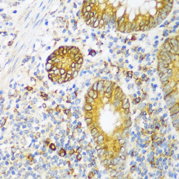 Immunohistochemistry - ERLIN1 Polyclonal Antibody 