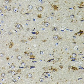 Immunohistochemistry - PTPN3 Polyclonal Antibody 
