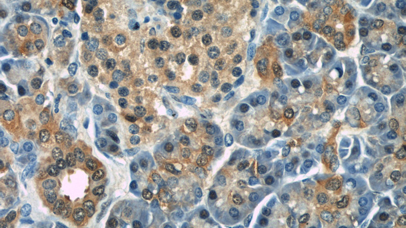 Immunohistochemical of paraffin-embedded human pancreas using Catalog No:114559(RBP1 antibody) at dilution of 1:50 (under 40x lens)