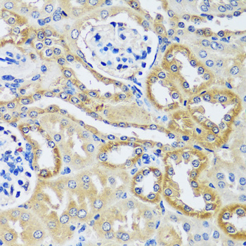 Immunohistochemistry - BLOC1S3 Polyclonal Antibody 