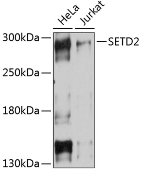 Western blot - SETD2 Polyclonal Antibody 