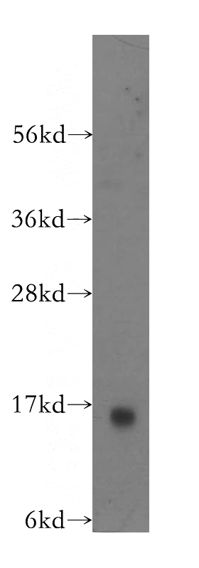 human liver tissue were subjected to SDS PAGE followed by western blot with Catalog No:110839(GAL1,LGALS1 antibody) at dilution of 1:500
