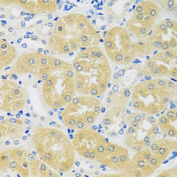 Immunohistochemistry - C1GALT1 Polyclonal Antibody 