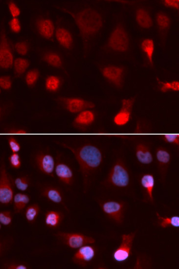 Immunofluorescence - ATP7B Polyclonal Antibody 