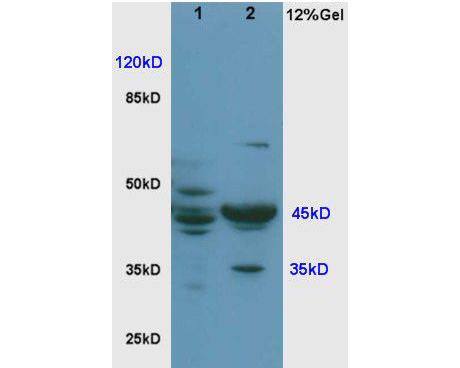 Fig1: Sample:; Brain(Rat) lysate at30ug;; Lung(Rat) lysate at 30ug;; Primary: Anti-Cyclin E at 1:200;; Secondary: HRP conjugated Goat-Anti-Rabbit IgG(bse-0295G) at 1: 3000;; Predicted band size : 45kD; Observed band size : 45kD