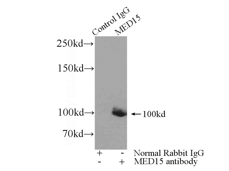 IP Result of anti-MED15 (IP:Catalog No:112584, 3ug; Detection:Catalog No:112584 1:500) with K-562 cells lysate 3440ug.