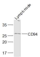 Fig1: Sample:; Lymph node (Mouse) Lysate at 40 ug; Primary: Anti-CD94 at 1/1000 dilution; Secondary: IRDye800CW Goat Anti-Rabbit IgG at 1/20000 dilution; Predicted band size: 20 kD; Observed band size: 20 kD