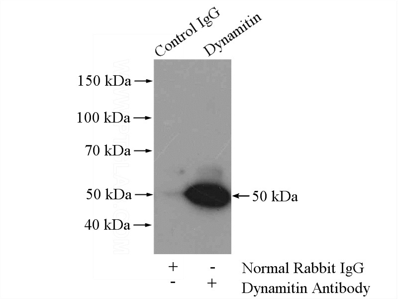 IP Result of anti-dynactin-2 (IP:Catalog No:110131, 4ug; Detection:Catalog No:110131 1:500) with mouse brain tissue lysate 4000ug.