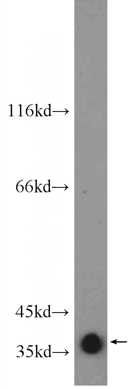 rat brain tissue were subjected to SDS PAGE followed by western blot with Catalog No:110990(GNAO1 Antibody) at dilution of 1:600