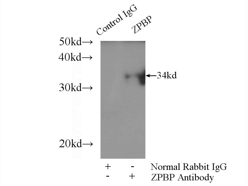IP Result of anti-ZPBP (IP:Catalog No:117263, 3ug; Detection:Catalog No:117263 1:300) with mouse testis tissue lysate 2800ug.