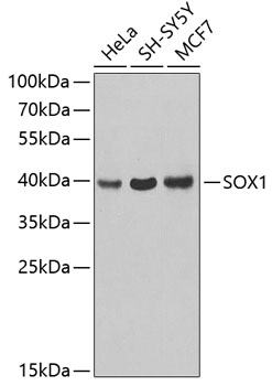 Western blot - SOX1 Polyclonal Antibody 