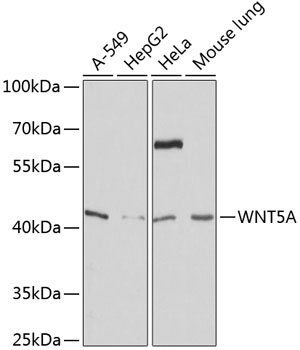 Western blot - WNT5A Polyclonal Antibody 