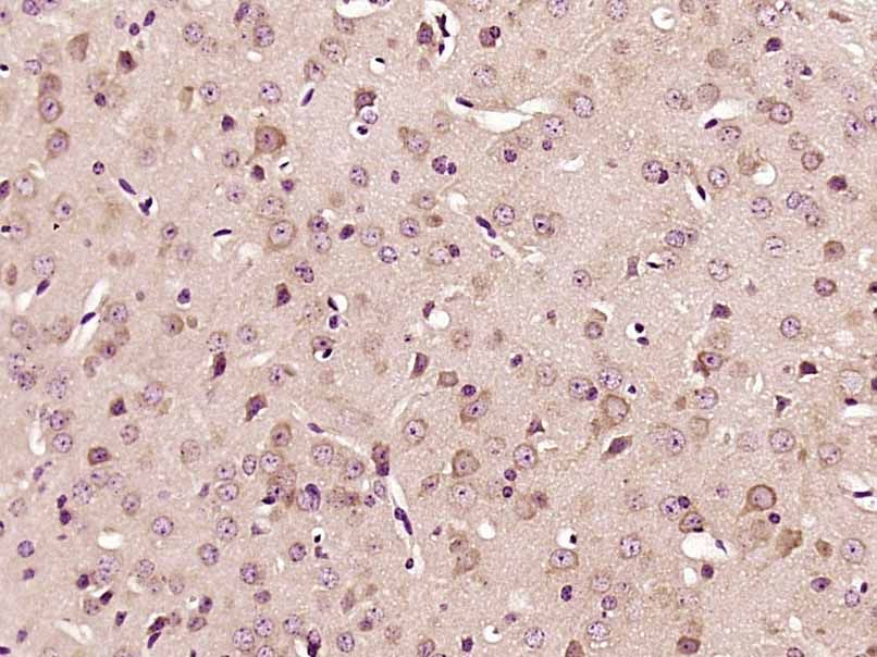 Fig1: Paraformaldehyde-fixed, paraffin embedded (Mouse brain); Antigen retrieval by boiling in sodium citrate buffer (pH6.0) for 15min; Block endogenous peroxidase by 3% hydrogen peroxide for 20 minutes; Blocking buffer (normal goat serum) at 37℃ for 30min; Antibody incubation with (PKC iota) Polyclonal Antibody, Unconjugated at 1:400 overnight at 4℃, followed by operating according to SP Kit(Rabbit) (sp-0023) instructionsand DAB staining.