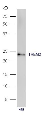 Fig1: Sample: Raji Cell lysate at 30ug;; Primary: Anti-TREM2 at 1:300 dilution;; Secondary: HRP conjugated Goat-Anti-rabbit IgG(bs-0295G-HRP) at 1: 5000 dilution;; Predicted band size: 23 kD; Observed band size: 23 kD