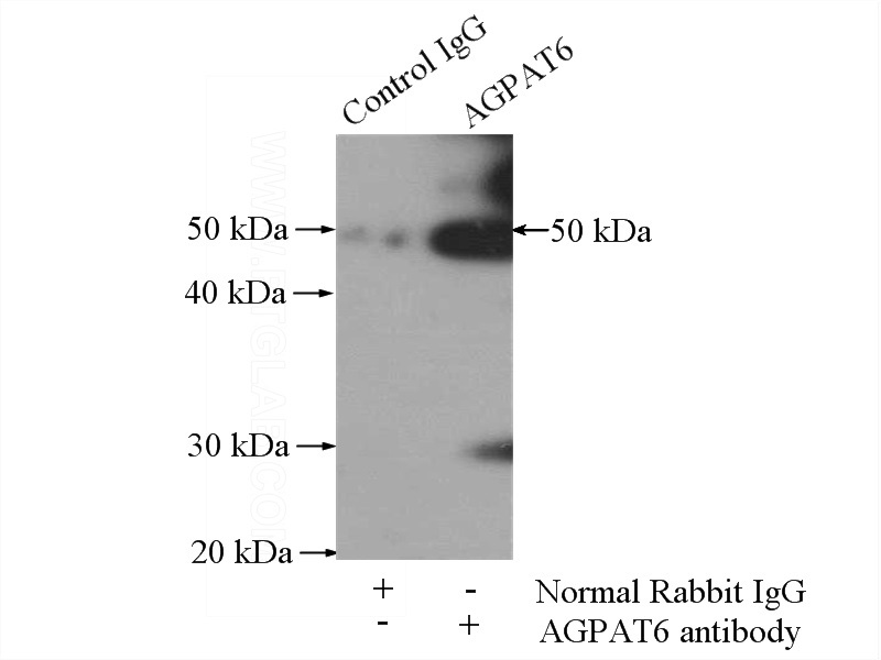 IP Result of anti-AGPAT6 (IP:Catalog No:107833, 4ug; Detection:Catalog No:107833 1:1000) with mouse brain tissue lysate 2640ug.