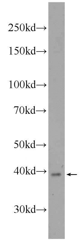 mouse colon tissue were subjected to SDS PAGE followed by western blot with Catalog No:116673(UCHL5 Antibody) at dilution of 1:300