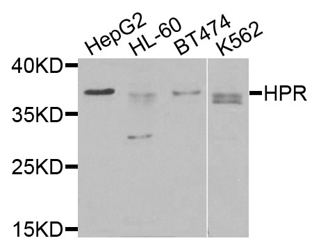 Western blot - HPR Polyclonal Antibody 