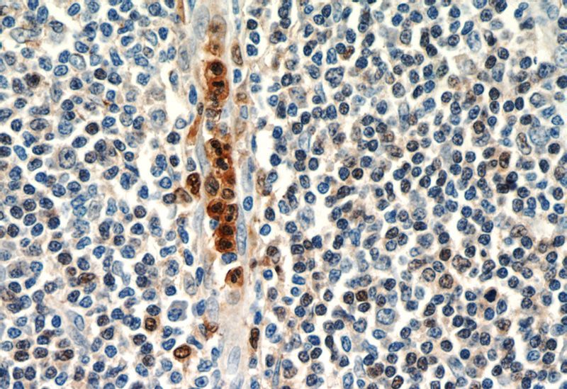 Immunohistochemistry of paraffin-embedded human tonsillitis slide using Catalog No:111157(GCA Antibody) at dilution of 1:50