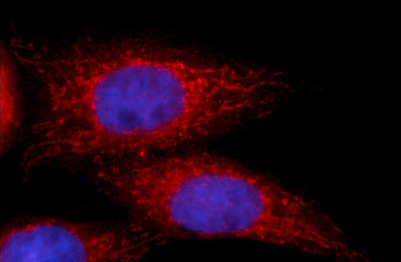 Immunofluorescent analysis of HepG2 cells using Catalog No:111358(hIST1 Antibody) at dilution of 1:25 and Alexa Fluor 594-congugated AffiniPure Goat Anti-Rabbit IgG(H+L)