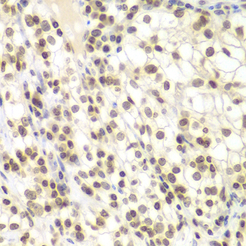 Immunohistochemistry - UHRF2 Polyclonal Antibody 