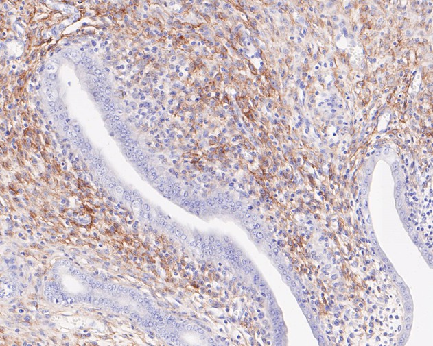 Fig5:; Immunohistochemical analysis of paraffin-embedded rat uterus tissue using anti-p75 NGF Receptor antibody. The section was pre-treated using heat mediated antigen retrieval with Tris-EDTA buffer (pH 8.0-8.4) for 20 minutes.The tissues were blocked in 5% BSA for 30 minutes at room temperature, washed with ddH; 2; O and PBS, and then probed with the primary antibody ( 1/50) for 30 minutes at room temperature. The detection was performed using an HRP conjugated compact polymer system. DAB was used as the chromogen. Tissues were counterstained with hematoxylin and mounted with DPX.