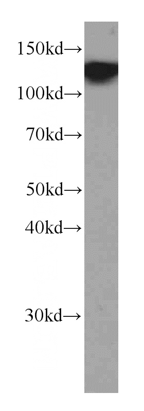 Raji cells were subjected to SDS PAGE followed by western blot with Catalog No:107053(CD22 antibody) at dilution of 1:1500