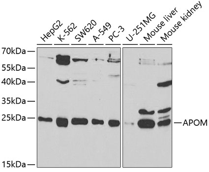 Western blot - APOM Polyclonal Antibody 