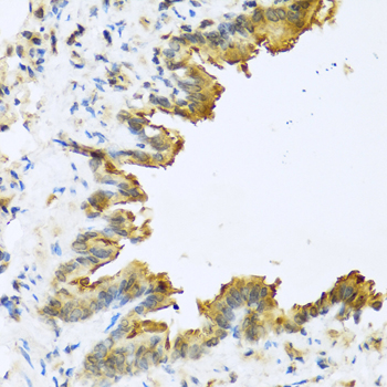 Immunohistochemistry - DEFB4A Polyclonal Antibody 
