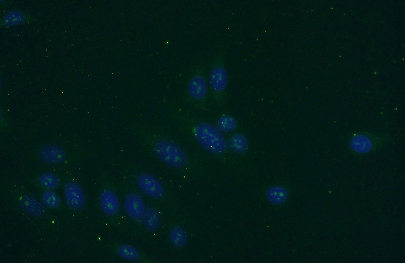 Immunofluorescent analysis of HepG2 cells using Catalog No:112123(KRI1 Antibody) at dilution of 1:50 and Alexa Fluor 488-congugated AffiniPure Goat Anti-Rabbit IgG(H+L)