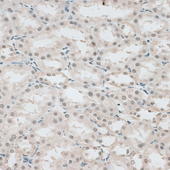 Immunohistochemistry - CBX6 Polyclonal Antibody 