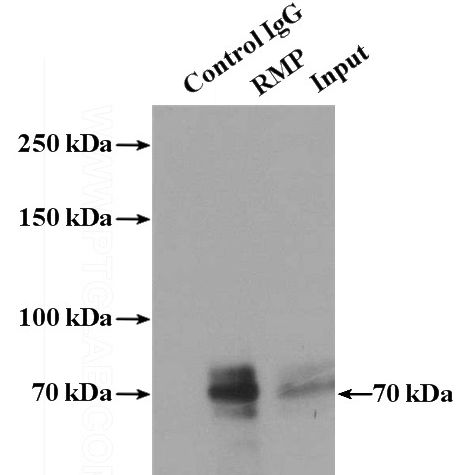 IP Result of anti-RMP (IP:Catalog No:114724, 4ug; Detection:Catalog No:114724 1:500) with HeLa cells lysate 1600ug.