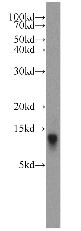 mouse liver tissue were subjected to SDS PAGE followed by western blot with Catalog No:108300(ATP5L antibody) at dilution of 1:800