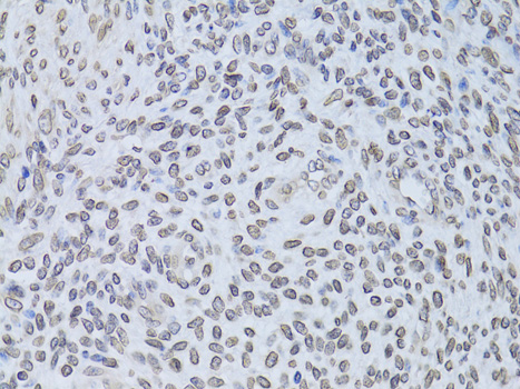 Immunohistochemistry - LMNB2 Polyclonal Antibody 