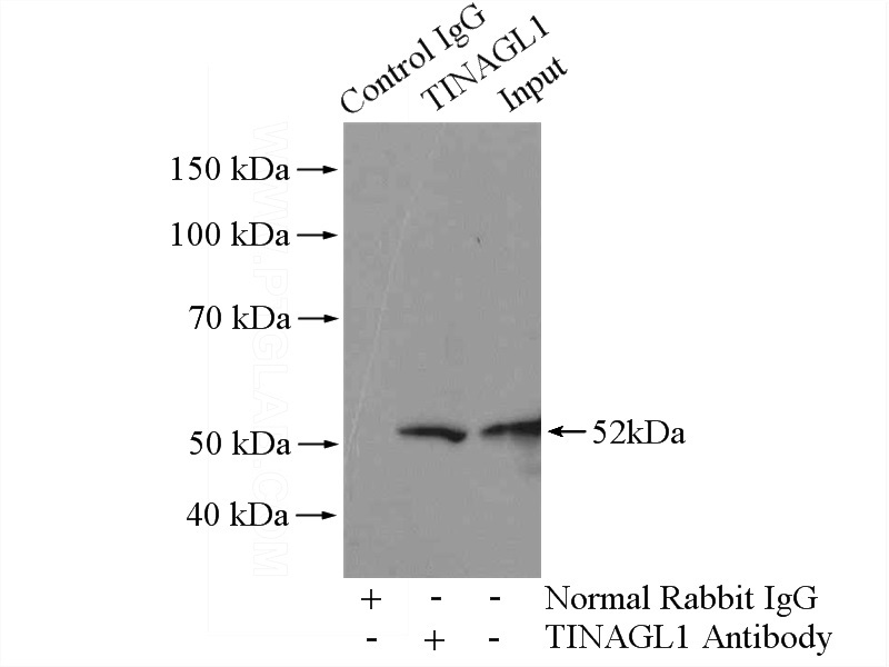 IP Result of anti-TINAGL1 (IP:Catalog No:116059, 4ug; Detection:Catalog No:116059 1:500) with mouse heart tissue lysate 4000ug.