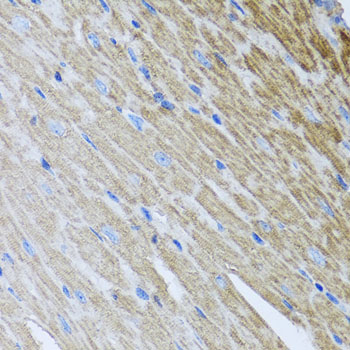 Immunohistochemistry - MTX2 Polyclonal Antibody 