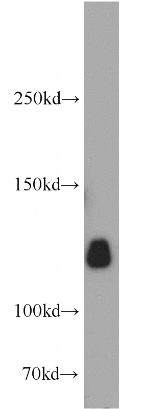 mouse brain tissue were subjected to SDS PAGE followed by western blot with Catalog No:112016(KIF5A antibody) at dilution of 1:2000