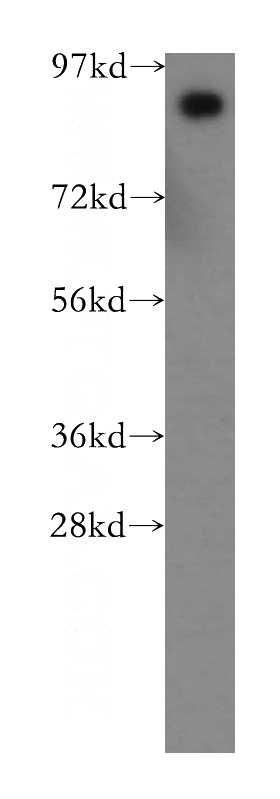 human liver tissue were subjected to SDS PAGE followed by western blot with Catalog No:114224(PROX1 antibody) at dilution of 1:500