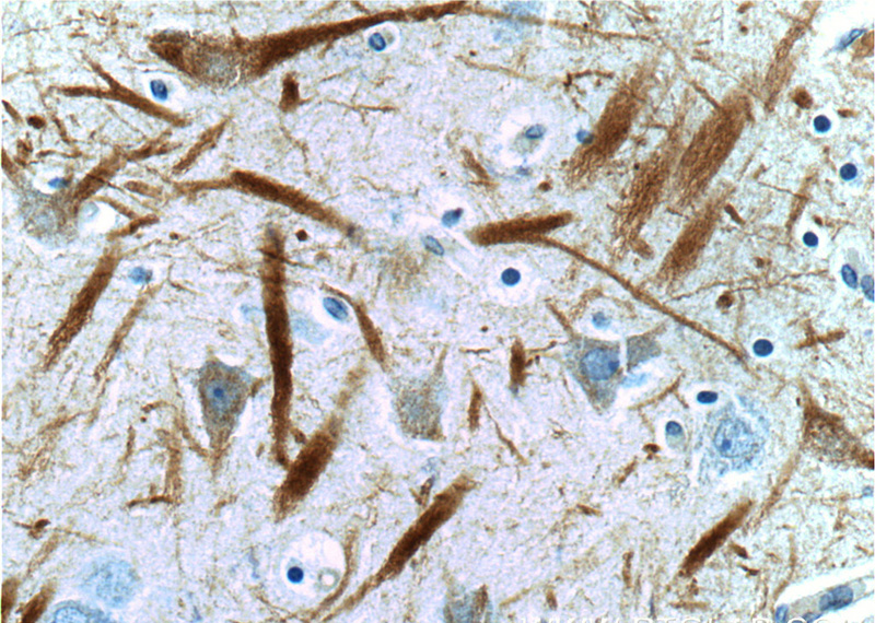 Immunohistochemistry of paraffin-embedded human brain tissue slide using Catalog No:113162(NEFL Antibody) at dilution of 1:200 (under 40x lens)